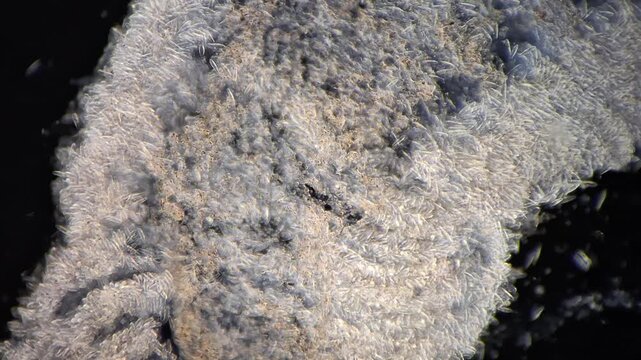 Microscopic view of Olindias phosphorica jellyfish tentacle showing dense cnidocytes in darkfield