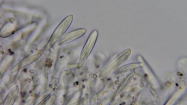 Microscopic view of jellyfish tentacle under microscope 