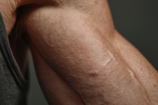 Close up inner elbow skin texture natural folds soft fcd caeb