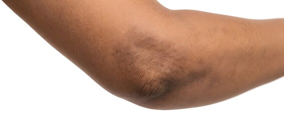 Naklejka premium Human elbow with dark skin texture detail isolated on white background