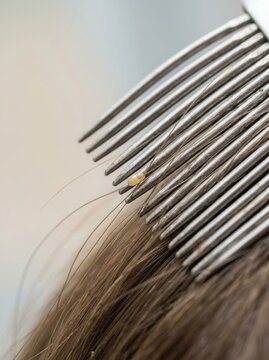 Macro shot of a metal nit comb catching a louse egg on a hair strand. Close up of nit attached to brown hair during head lice treatment
