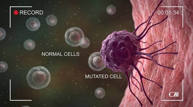 Microscopic view showing mutated cancerous cell invading surrounding healthy