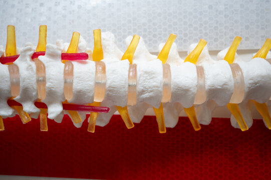 Lumbar spine anatomical model showing vertebrae, discs and spinal nerves