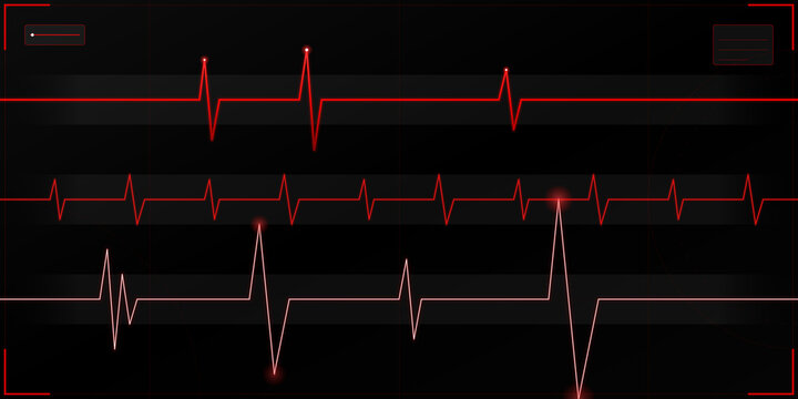 Red heartbeat ekg monitor lines digital interface medical display graphic on transparent background