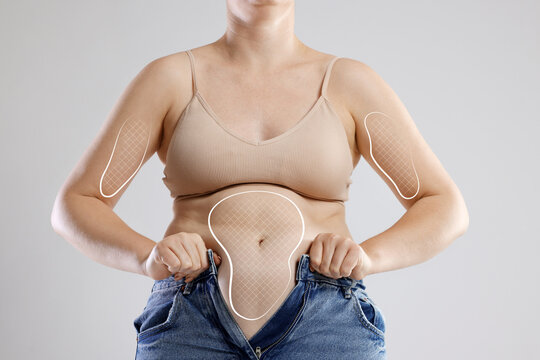 Overweight woman trying to put on tight jeans against gray background, closeup. Marks showing areas of excess weight