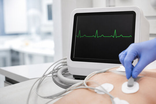 Medical ecg monitor displaying heart rhythm during patient examination in clinic. Professional doctor connecting sensors to body. Concept of cardiology, healthcare, diagnostics, and modern