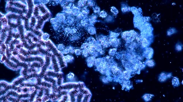 Period Blood under the Microscope