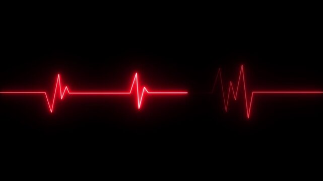 Neon ECG heartbeat pulse line on a dark background.Glowing electrocardiogram wave showing medical health monitor, emergency cardiology signal and life rhythm.