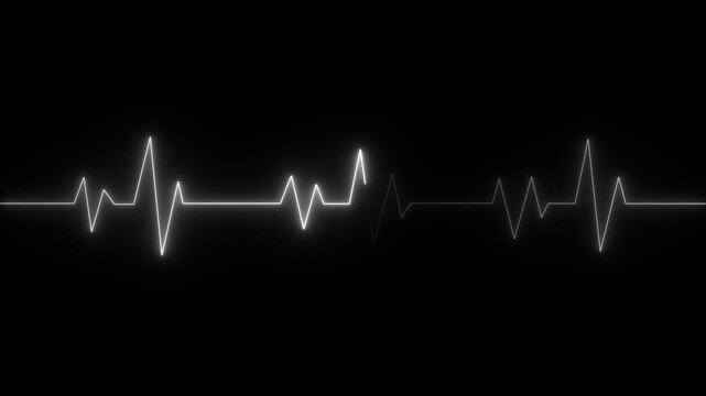 Monitoring in an emergency ECG line animation. Heartbeat signal icon cardiogram motion graphics. Medical concept EKG pulse wave. Electrocardiogram shows heart beat lines.ECG cardiogram oscilloscope.