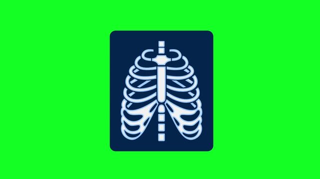 Animated Chest X-ray Scan Icon Rotating on Green Screen Background for Medical Concepts