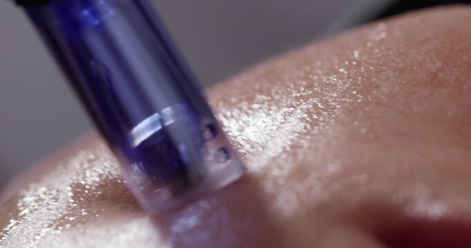 Slow motion close up of microneedling pen pressing into facial skin in clinical setting macro tracking shot.