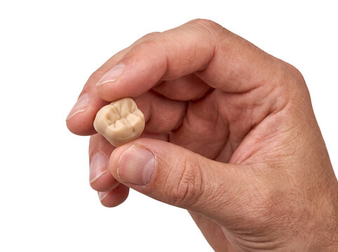 Dental crown molar tooth implant held by hand close up for prosthodontics modern dentistry healthcare treatment ceramic 3d printed restoration technology isolated studio shot on black background
