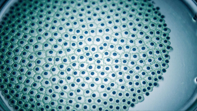 Microscopic view of plant cells with nuclei in a petri dish