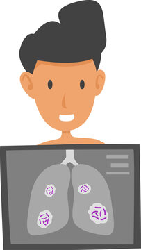 mycobacterium tuberculosis infection disease and symptoms concept