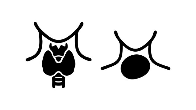 Healthy Thyroid versus Swollen Goiter Medical Comparison Icons