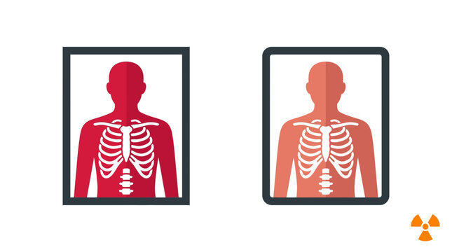 Human rib cage skeletal anatomy vector graphic illustration featuring red and light coral color scheme variations