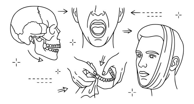 Jaw Injury and First Aid Diagram Vector Illustration Set featuring Human Skull Open Mouth Screaming Face and Head Bandage Line Art