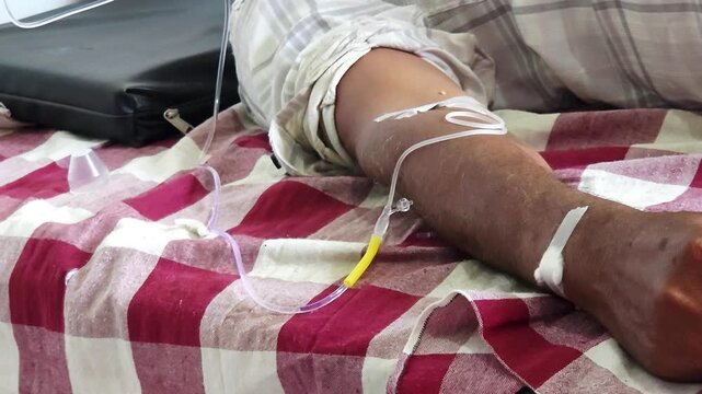 A peripheral IV catheter is secured with tape in a patient's arm. Clear tubing delivers essential fluids directly into the vein, a common procedure in standard hospital care and medical treatments.