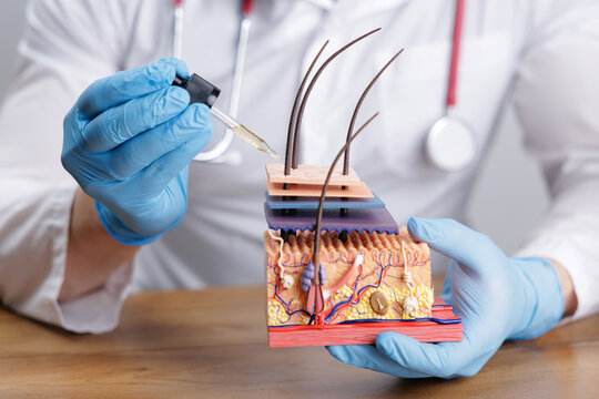 Clinical demonstration of layered skin anatomy model with hair roots and dropper oil held by physician for dermatology education