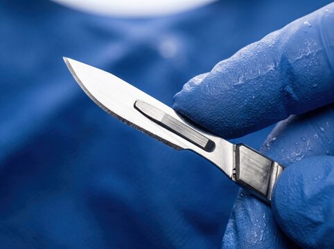 Gloved hand holding a sharp surgical scalpel signifies precision and strategic intervention required for complex asset protection.