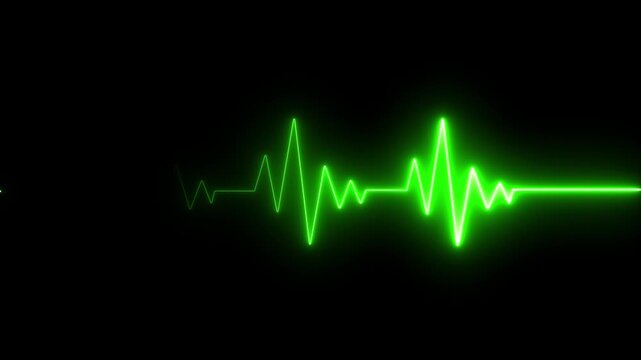 Neon green ekg heartbeat monitor pulse line animation on black background, medical