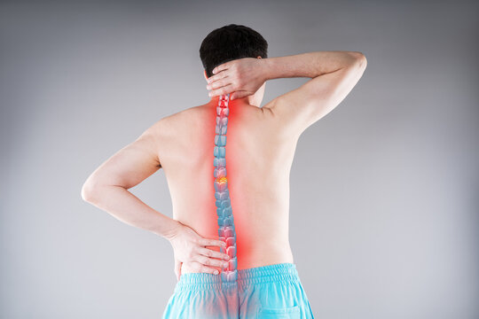 Lumbar and cervical spine hernia, man with back pain, compression injury of the intervertebral disc
