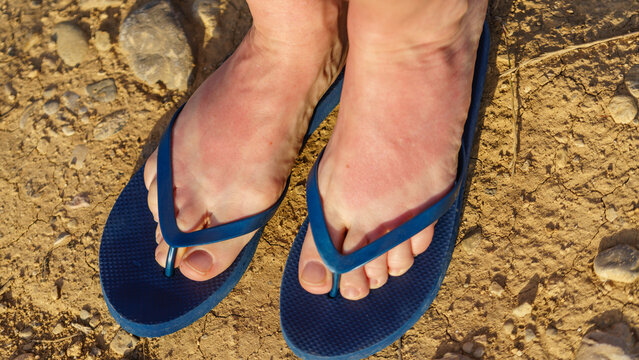 Sunburned feet wearing blue flip-flops on a sandy surface during a sunny day at the beach in summer