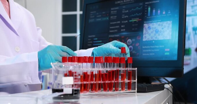 Scientist in gloves handling a blood sample tube near test tubes and a medical data screen in a laboratory, clinical research, diagnostics, and modern healthcare work.