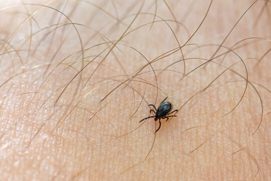 Tick on human skin close-up macro