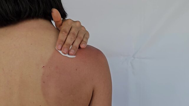 Applying sunscreen to prevent sunburn on the shoulder at the beach during a sunny day
