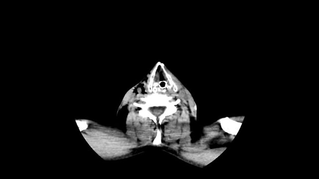 Axial CT Scan Slice Sequence Ascending from Neck and Face to Brain Anatomy