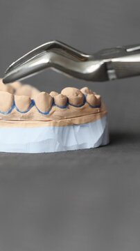 Gloved hand using stainless steel dental extraction forceps on plaster tooth model with blue orthodontic wire outline, close-up dental education demonstration on dark textured stone table background