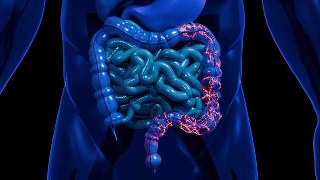 Human Colon Cancer Anatomy Highlighting Malignant Tumor Growth Along the Large Intestine Representing Colorectal Carcinoma Gastrointestinal Oncology Disease Progression and Medical Research 3D Renderi