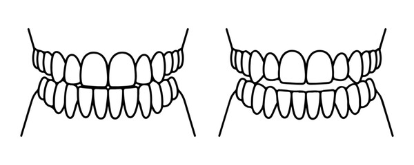 Upper and lower jaw dentures set dental prosthesis demonstration medical outline illustration. © Sen