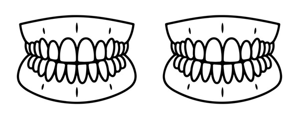 Dentures set upper and lower jaw dental prosthesis demonstration medical outline illustration. © Sen