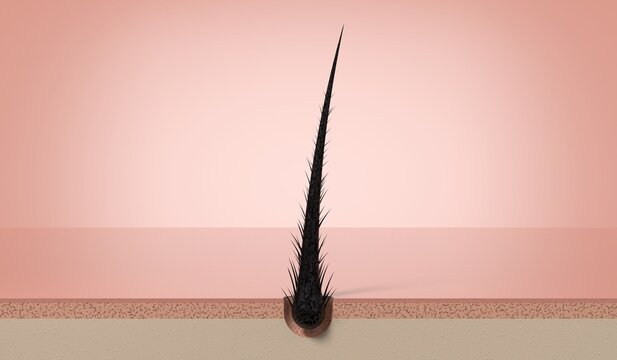 Severely damaged single hair strand with split structure on scalp - 3d illustration