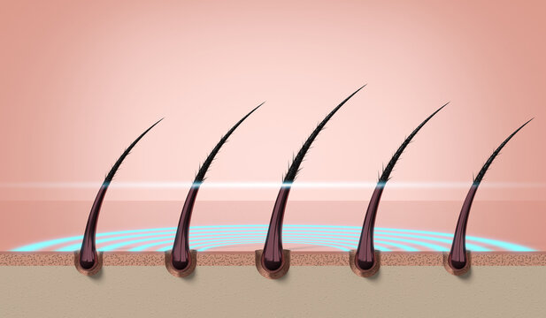Row of multiple hair strands with protective layer on scalp surface - 3d illustration