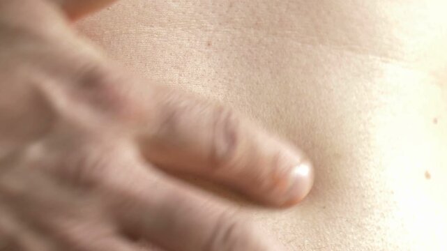 Close-up of a mole on a middle-aged man&rsquo;s skin, highlighting asymmetry, irregular borders, and color variations as potential signs of melanoma risk.