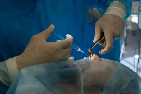 Plastic surgeon with syringe and dilator performing anesthesia before rhinoplasty.