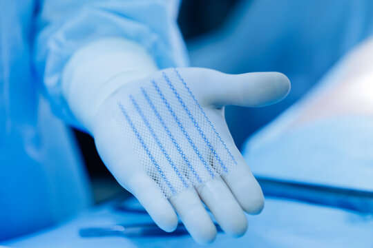 Surgeon holding medical mesh in gloved hand during procedure after umbilical hernia removal