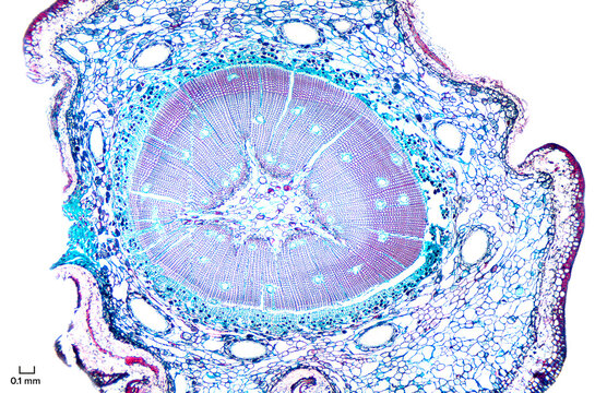 Pine root, cross section, under the microscope. Root of a conifer, cut perpendicular to longitudinal axis, hematoxylin-eosin stained, shot with 4X objective and 2X camera adapter. Scale in mm. Photo