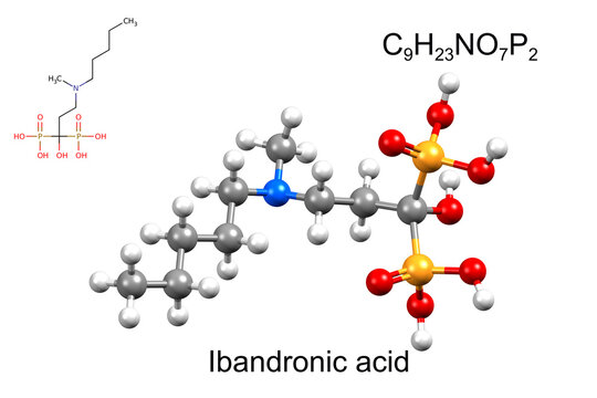 Structure of ibandronic acid, a medicine for osteoporosis. Chemical formula, structural formula, and 3D ball-and-stick model