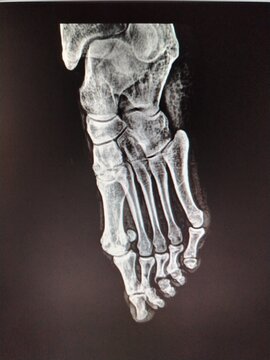 Dislocation