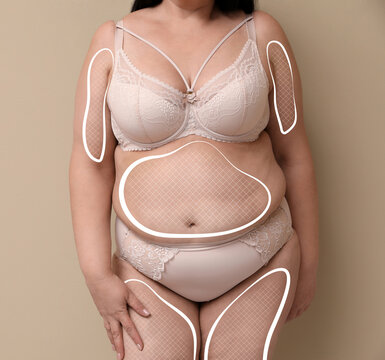 Overweight woman in underwear with marks on her body against beige background, closeup