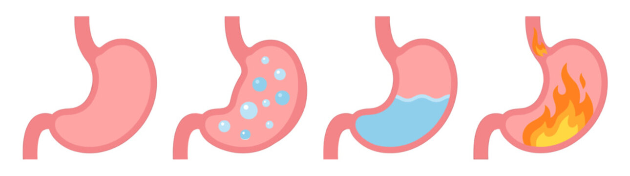 Diagram showing stomach health progression, empty stomach, gas bubbles, liquid intake, and heartburn with stomach on fire illustration