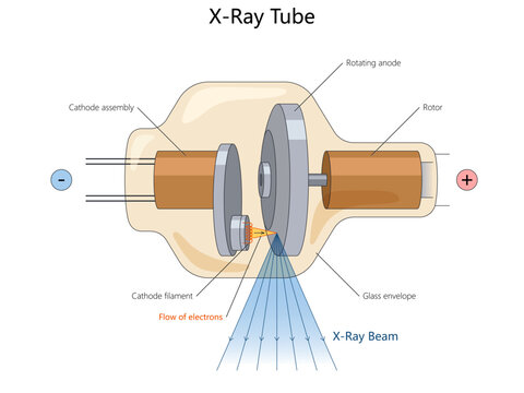 Educational cutaway diagram shows an X-ray tube, electron flow, rotating anode, cathode filament, rotor, glass envelope, and emitted beam.