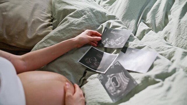 Closeup ultrasound photos pregnant belly bed. Woman examining sonogram scans.