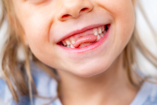 happy positive funny toothless 6-year-old girl, Close-up smiling child's face, showcasing missing baby teeth and joyful expression, waiting for toothfairy, innocence, growth, and childhood milestones