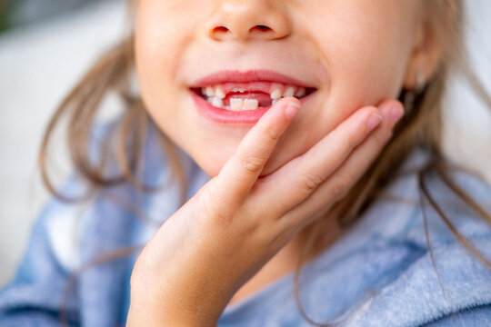 happy positive funny toothless 6-year-old girl, Close-up smiling child's face, showcasing missing baby teeth and joyful expression, waiting for toothfairy, innocence, growth, and childhood milestones