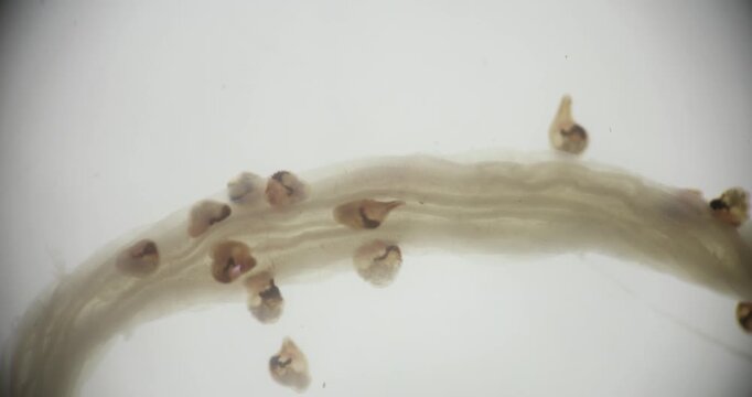 Freshwater Trematode Parasites: Clinostomum, Postorchigenes and Thapariella spp. for education in Lab.